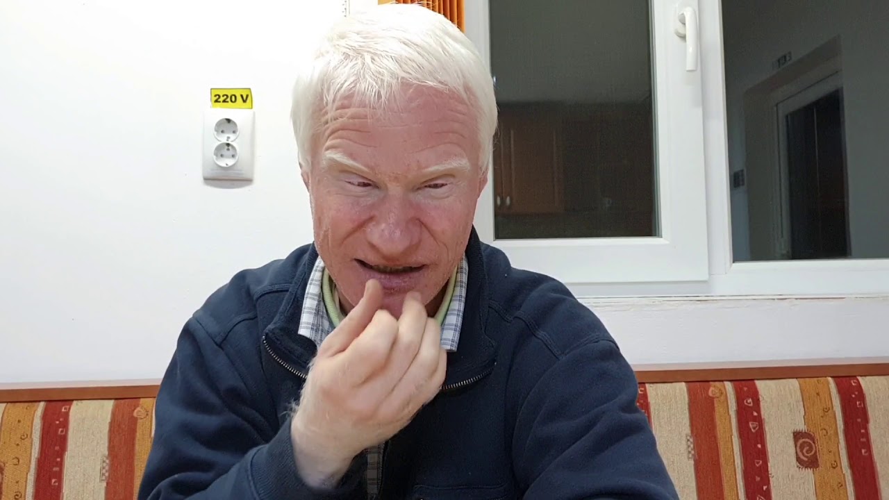 Povestea uimitoare a lui Teodor Amuntencei - un tânăr cu albinism de la Iași - Tibănești