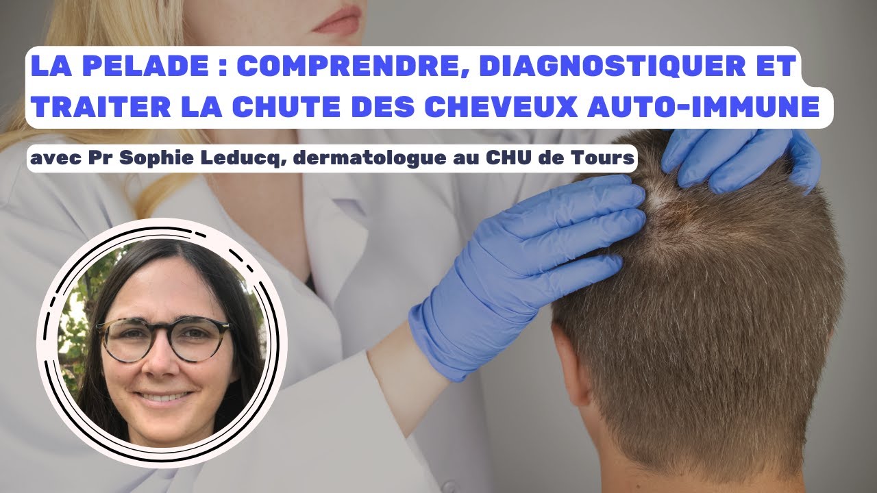 La pelade : comprendre, diagnostiquer et traiter la chute des cheveux auto-immune
