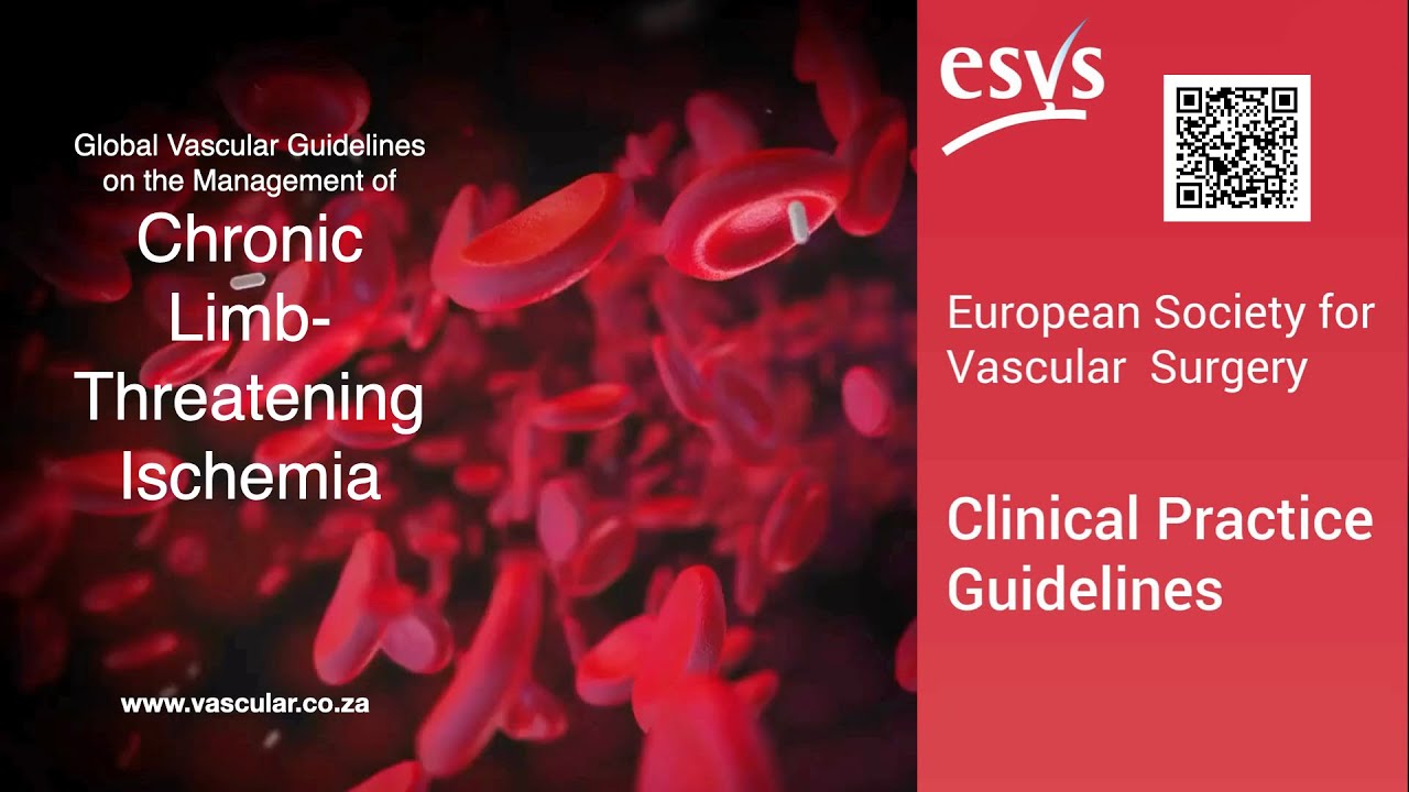 Management of ChronicLimb-Threatening Ischemia