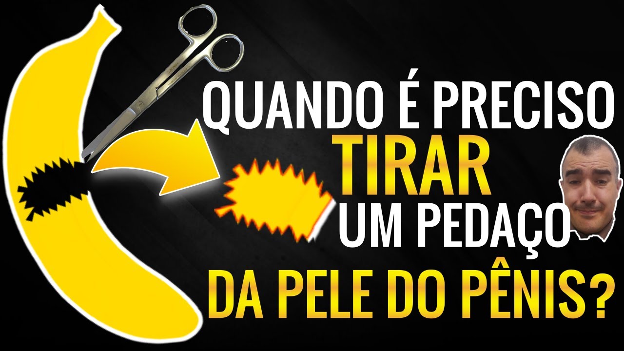 Em que situa&ccedil;&otilde;es se realiza uma BI&Oacute;PSIA DO P&Ecirc;NIS (tirar um pedacinho  da pele)?