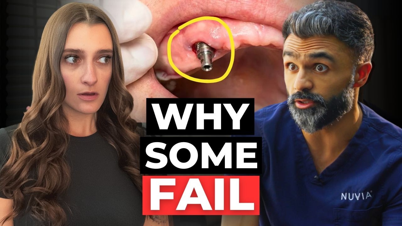 Why Don’t All Dental Implants Last Forever?