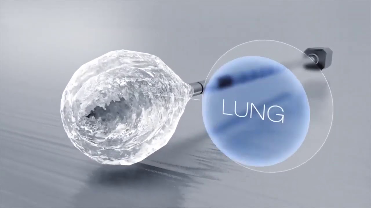 WREG Live at 9 - Cryoablation Therapy with Dr. Richard Fine