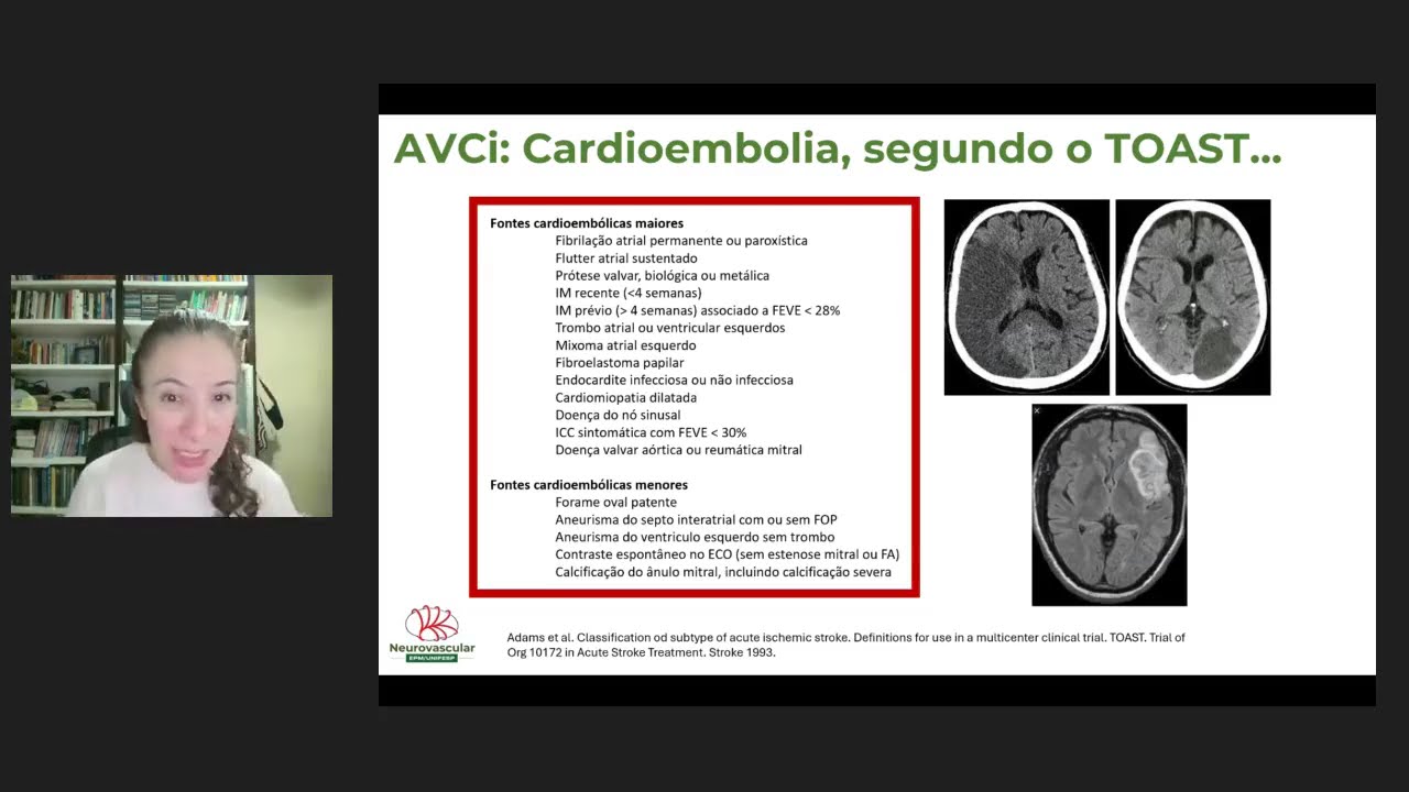 AVCi Cardioembólico: Diagnóstico e Tratamento