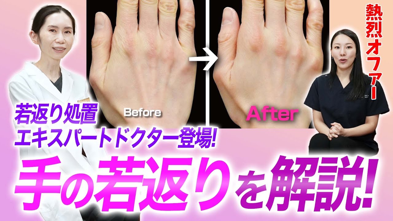 【手年齢を改善】手元の若返りについて池内医師と解説します。