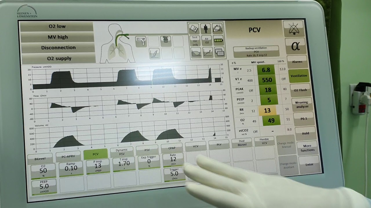 شرح جهاز  Dr.nazzal )  ventilator (elisa)/RCU  part1)