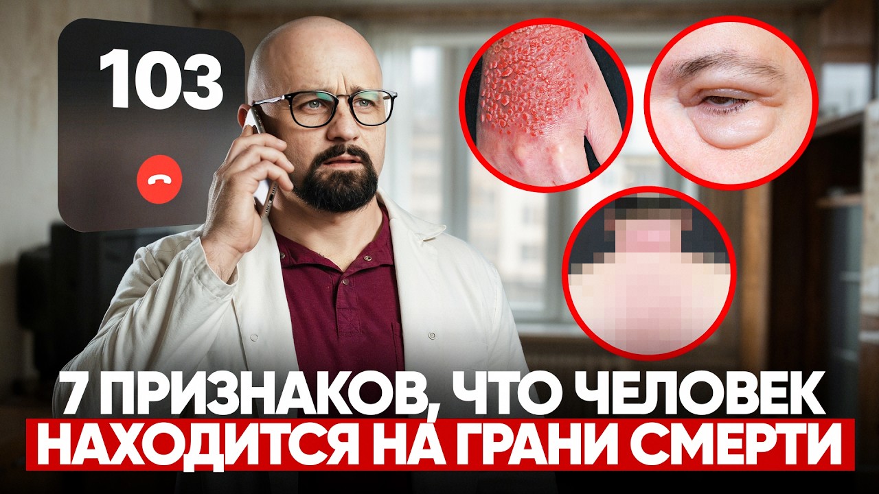 ЭТИ СИМПТОМЫ ОПАСНЫ ДЛЯ ЖИЗНИ! СРОЧНО ВЫЗЫВАЙТЕ СКОРУЮ!
