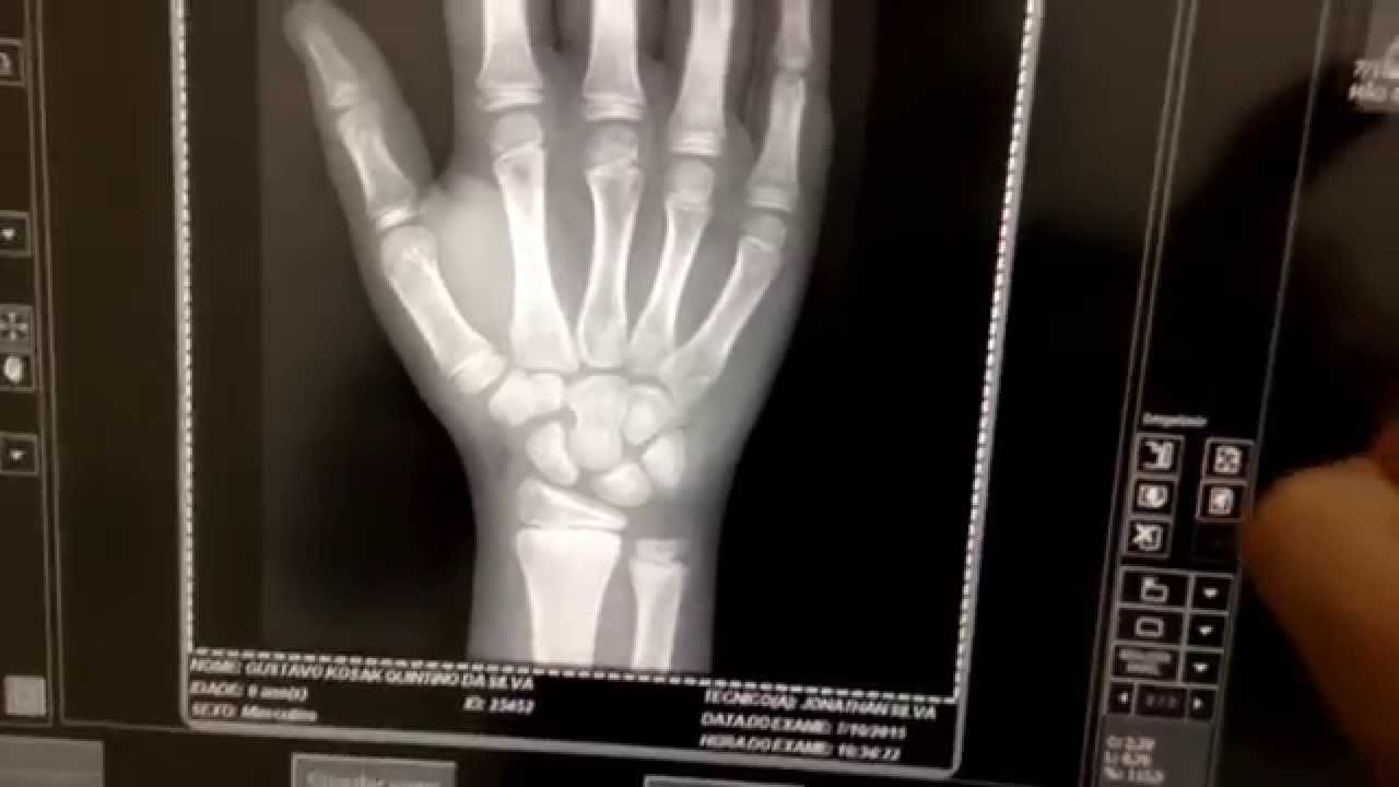 COMO REALIZAR RADIOGRAFIAS DIGITAIS