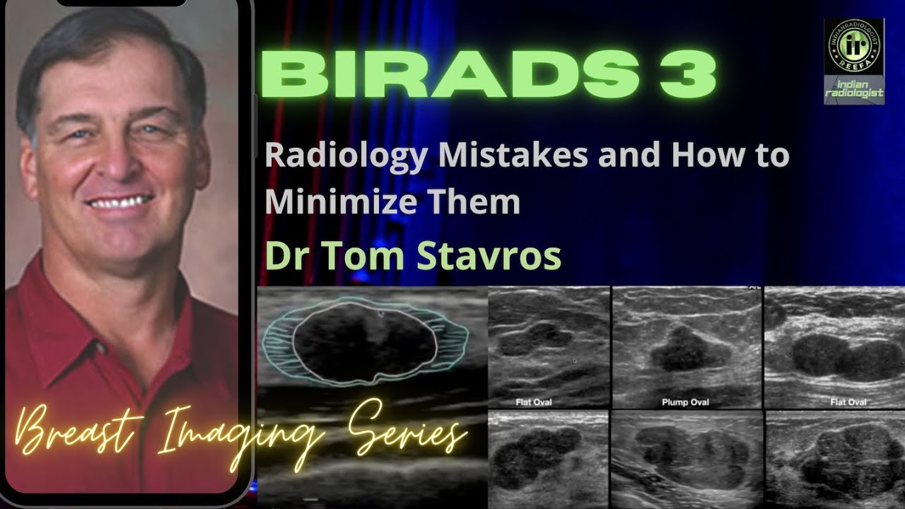 DR TOM STAVROS | BIRADS 3 - Common Mistakes Made by Radiologists and how to avoid them | Breast USG
