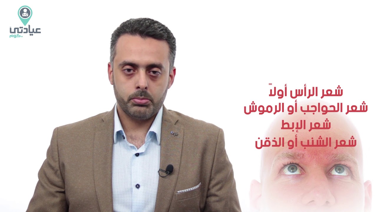 اكتر موضوع بيشغل مرضي السرطان هو الشعر هيقع ولا لا ! | د/ احمد عبد الهادي