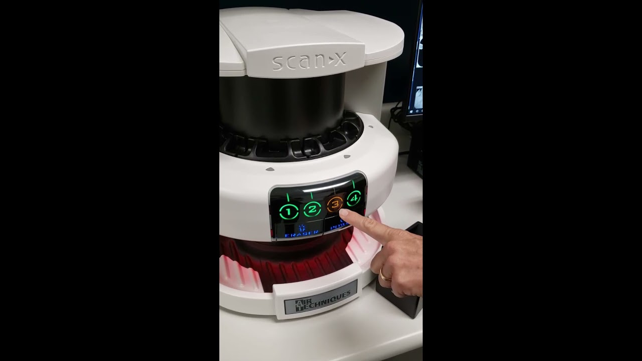 Dental Radiography - Scanning