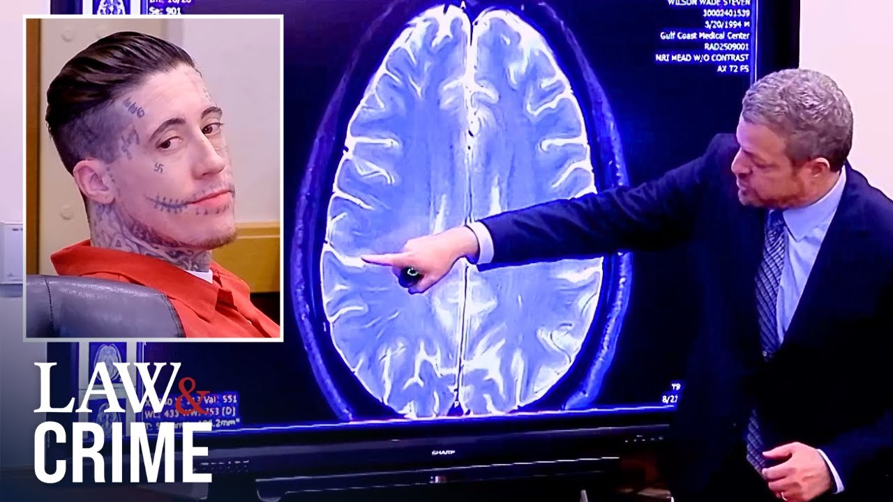 Tattooed Killer Wade Wilson Had Brain Injuries That Caused Emotional Disfunction: Doctor