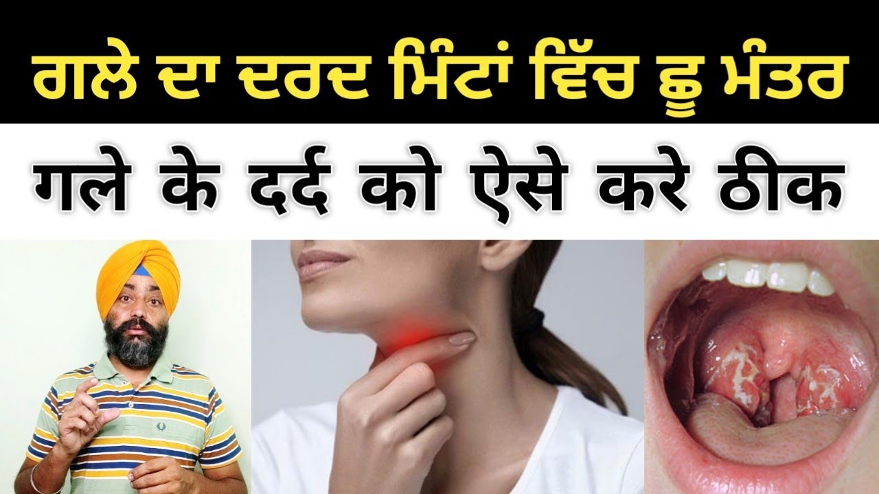 ਗਲਾ ਦਰਦ ਮਿੰਟਾ ਵਿਚ ਕਰੋ ਠੀਕ || गले में दर्द है तो ऐसे करे ठीक || @dstalanian
