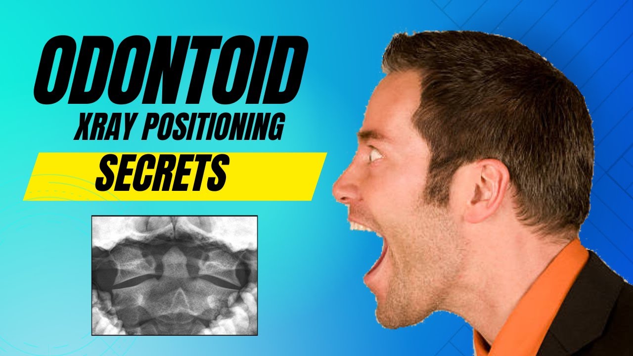 The Secret Radiology Hack for Perfect Odontoid X-Rays