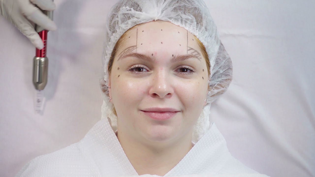 Botox sem agulha: uma caneta &eacute; capaz de fazer isso! I VIX Glam Brasil