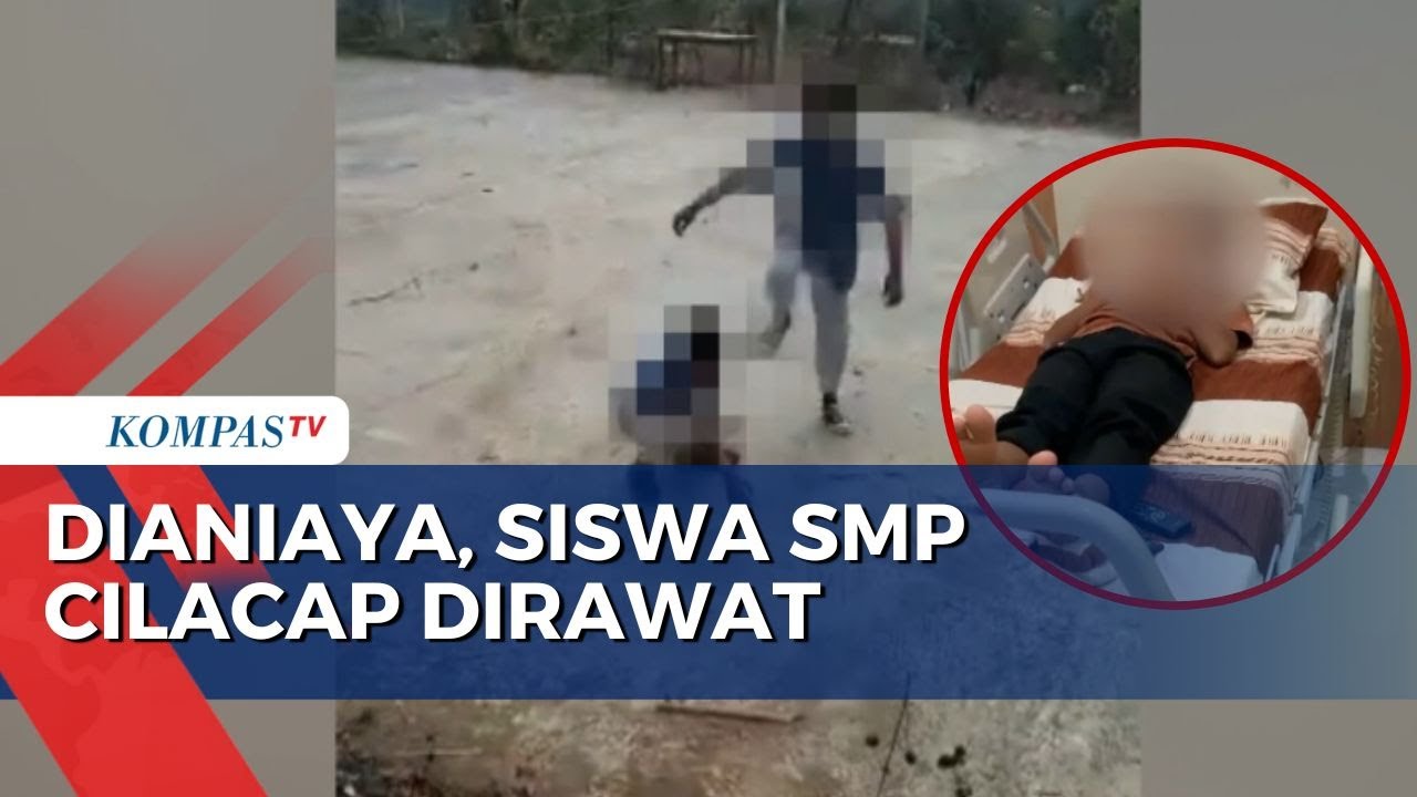 Siswa SMP Cilacap Korban Penganiayaan Kini Dirawat Intensif