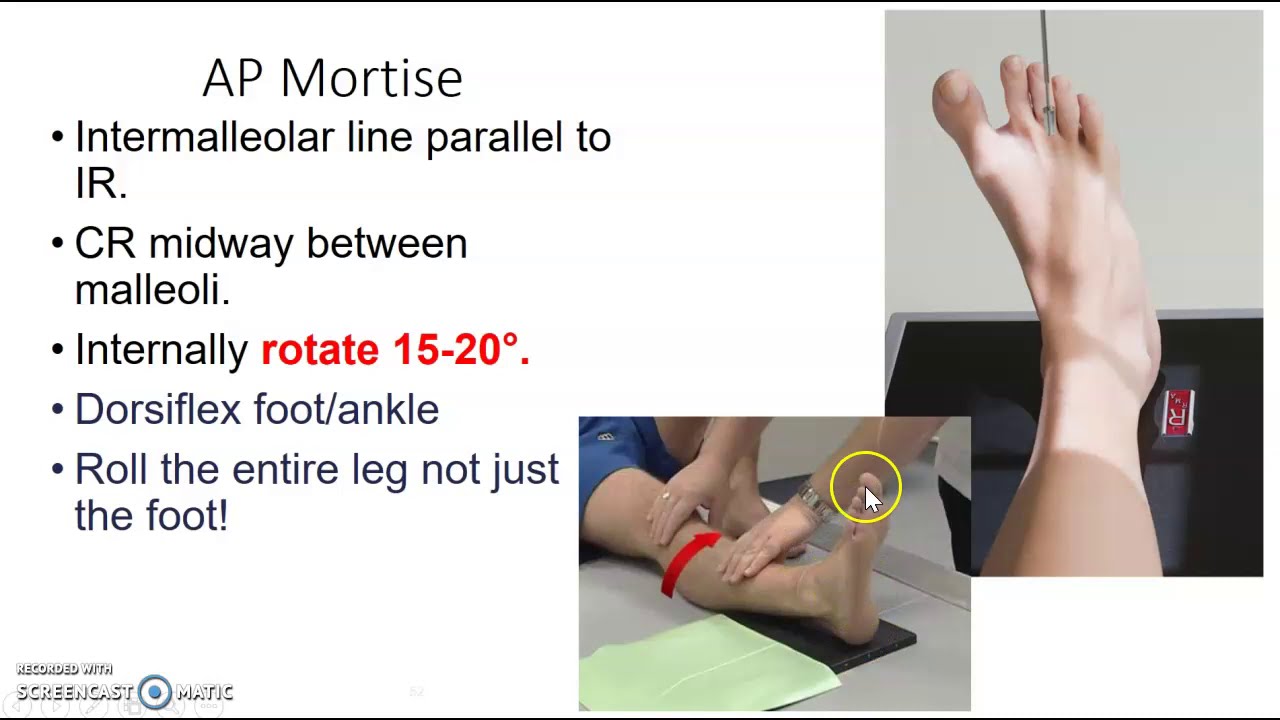 Foot, toes, calcaneus & ankle x-ray protocol