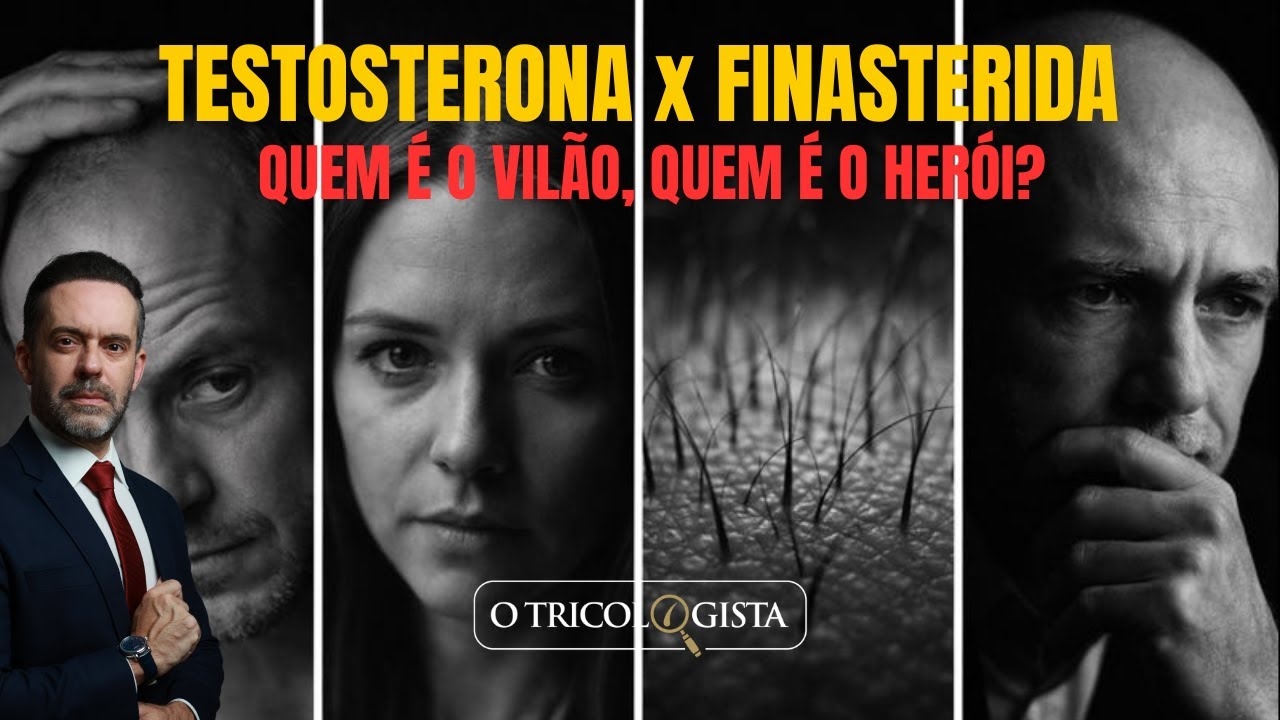 TESTOSTERONA x FINASTERIDA: QUEM É O VILÃO, QUEM É O HERÓI?