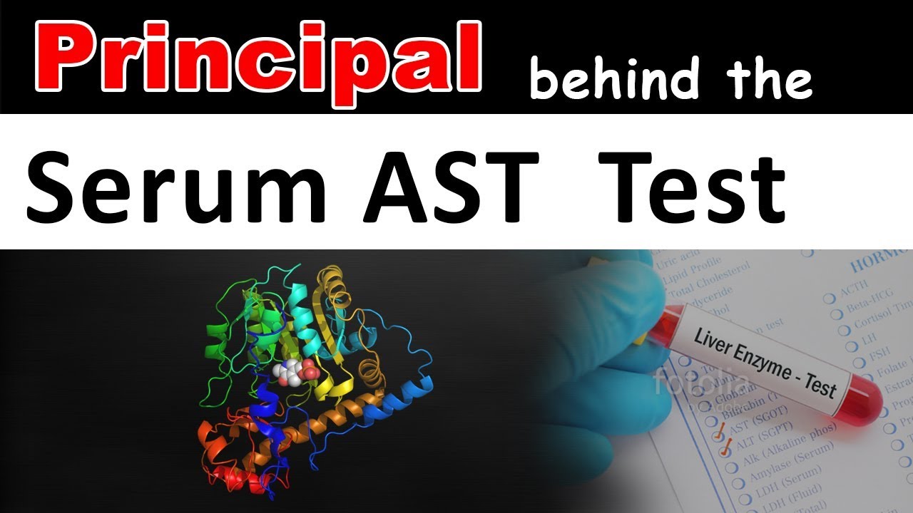 Принцип теста AST