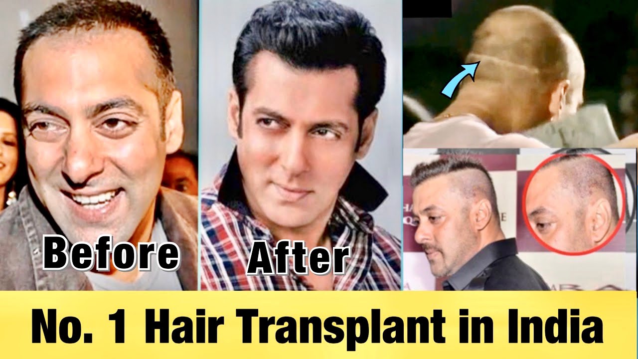Top Secrets of Salman Khan Hair | सलमान खान के घने बालों का राज़ जानकर चोक़ जाओगे