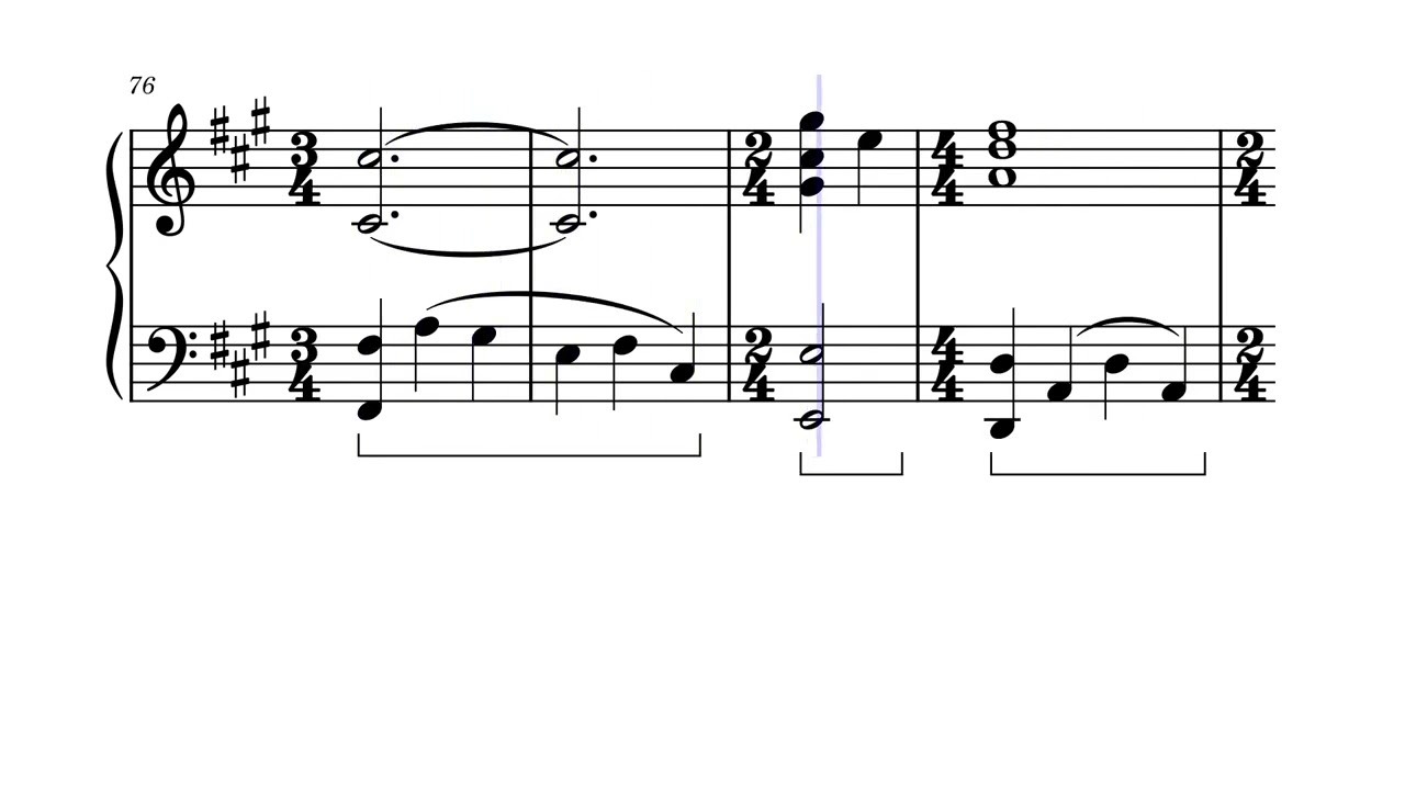Lilium (Elfen Lied OP) Piano Arr.