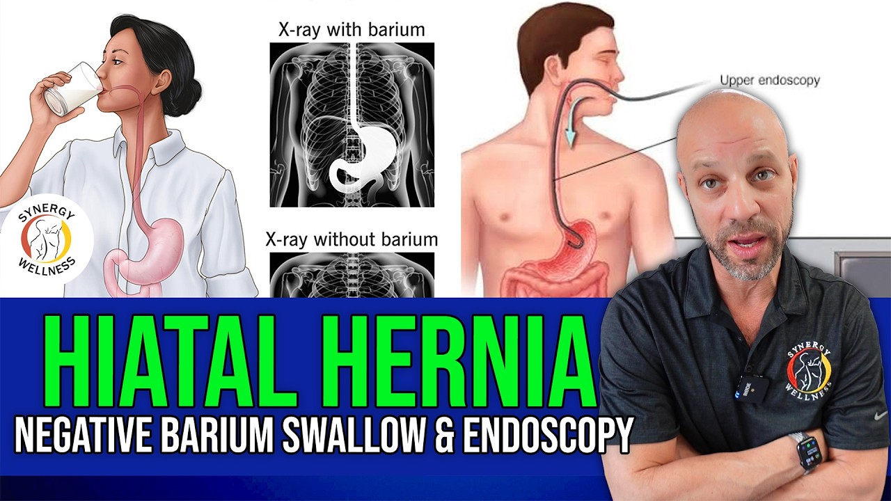 Может ли у меня быть грыжа пищеводного отверстия диафрагмы при отрицательных результатах эндоскоп...