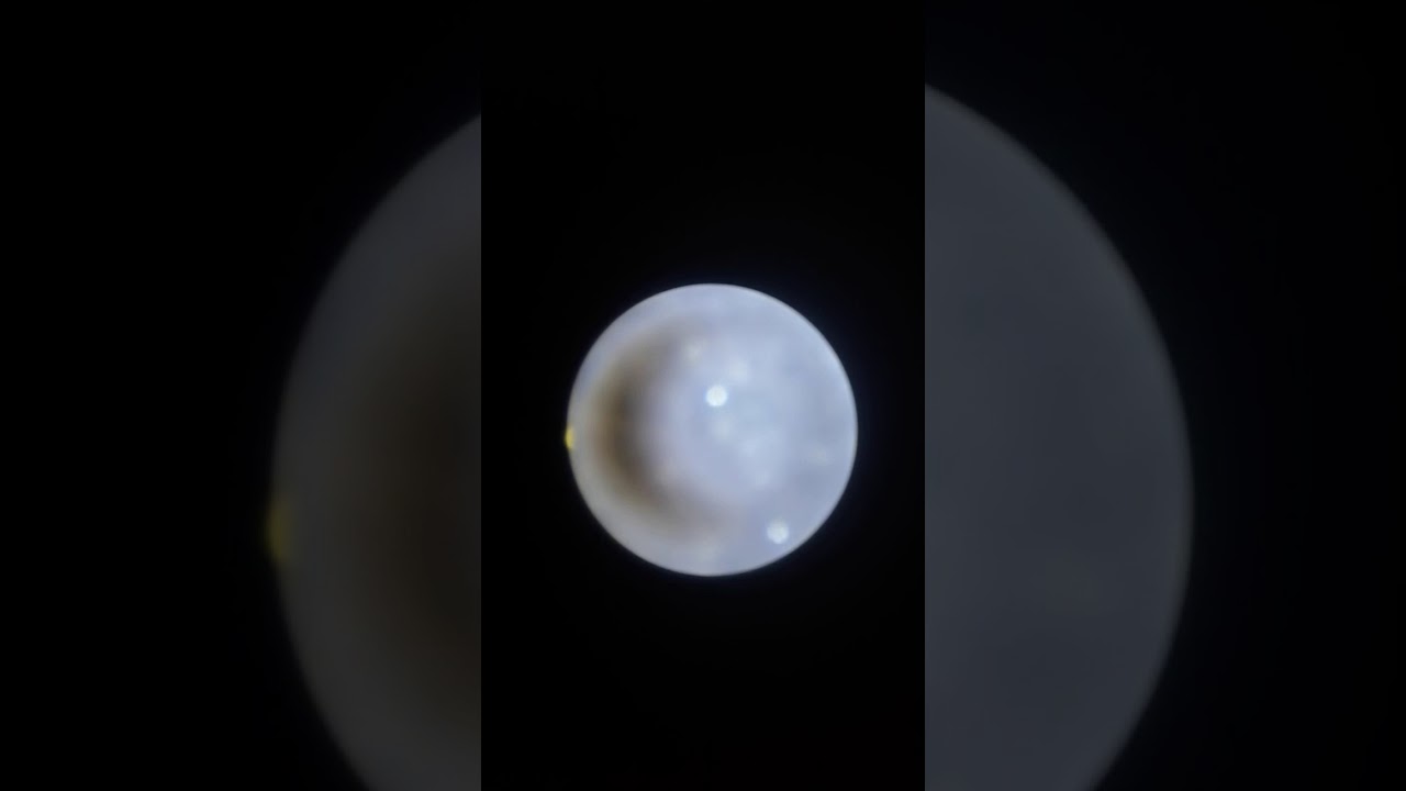 4 minutos con el microscopio