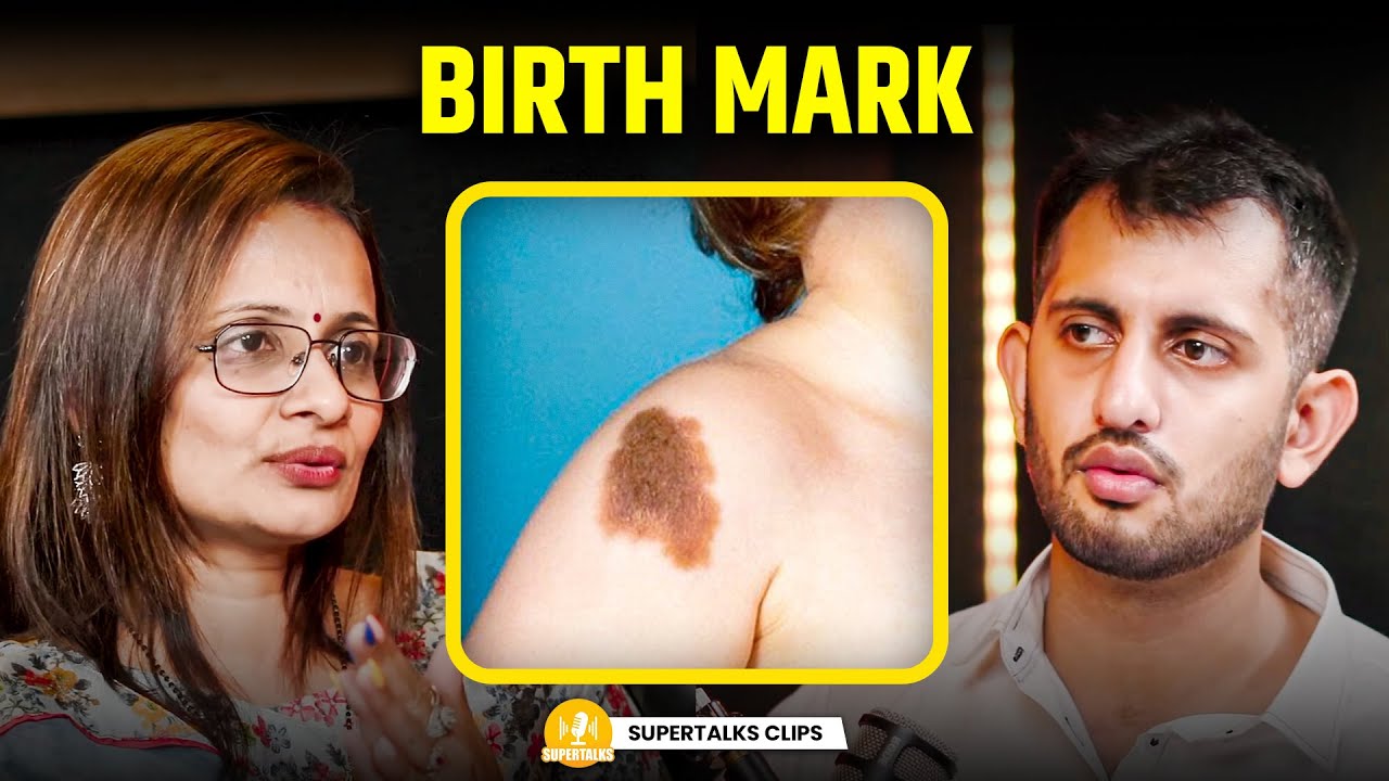 Birth Mark भाग्य लाता है या दुर्भाग्य? | Past Life Connection | ft. Ekta Desai