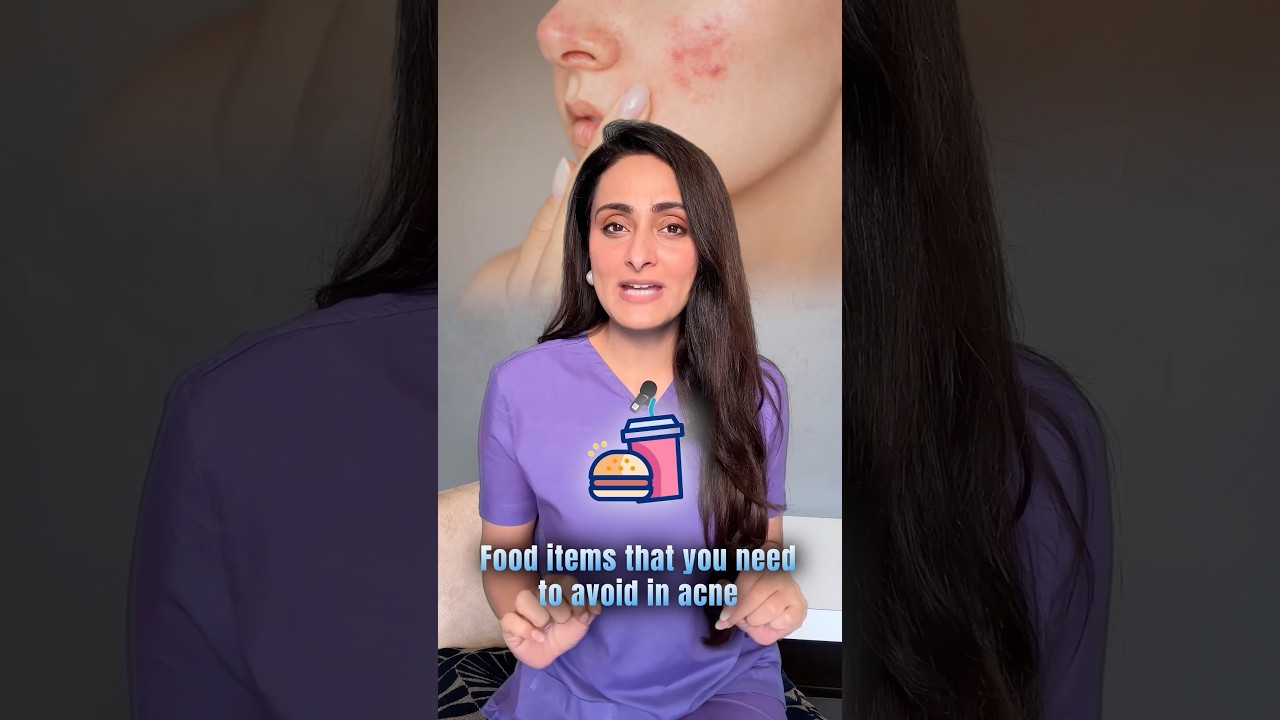 Avoid these if you have acne