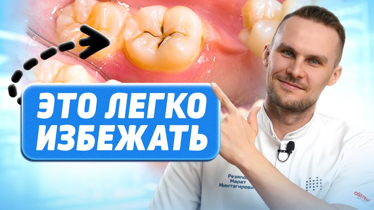 Если на зубах появляются чёрные точки – это ВИДЕО ДЛЯ ВАС