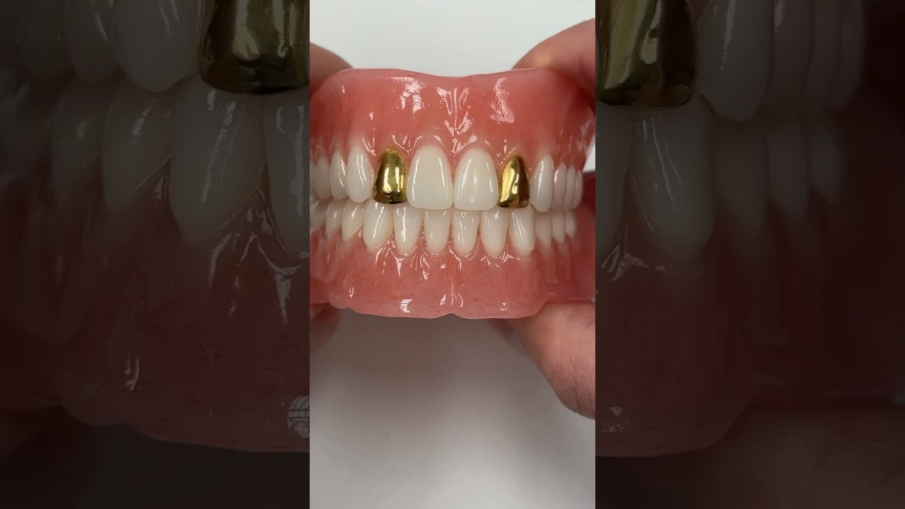 Process Denture with Gold Incisors #dental #smile #teeth #shorts #shortvideo #gold #dentures