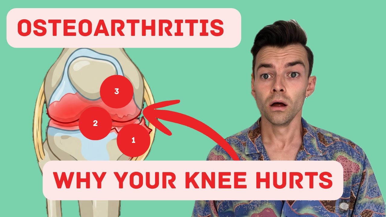 Knee Osteoarthritis in 5 Minutes (Including The Best Treatment)