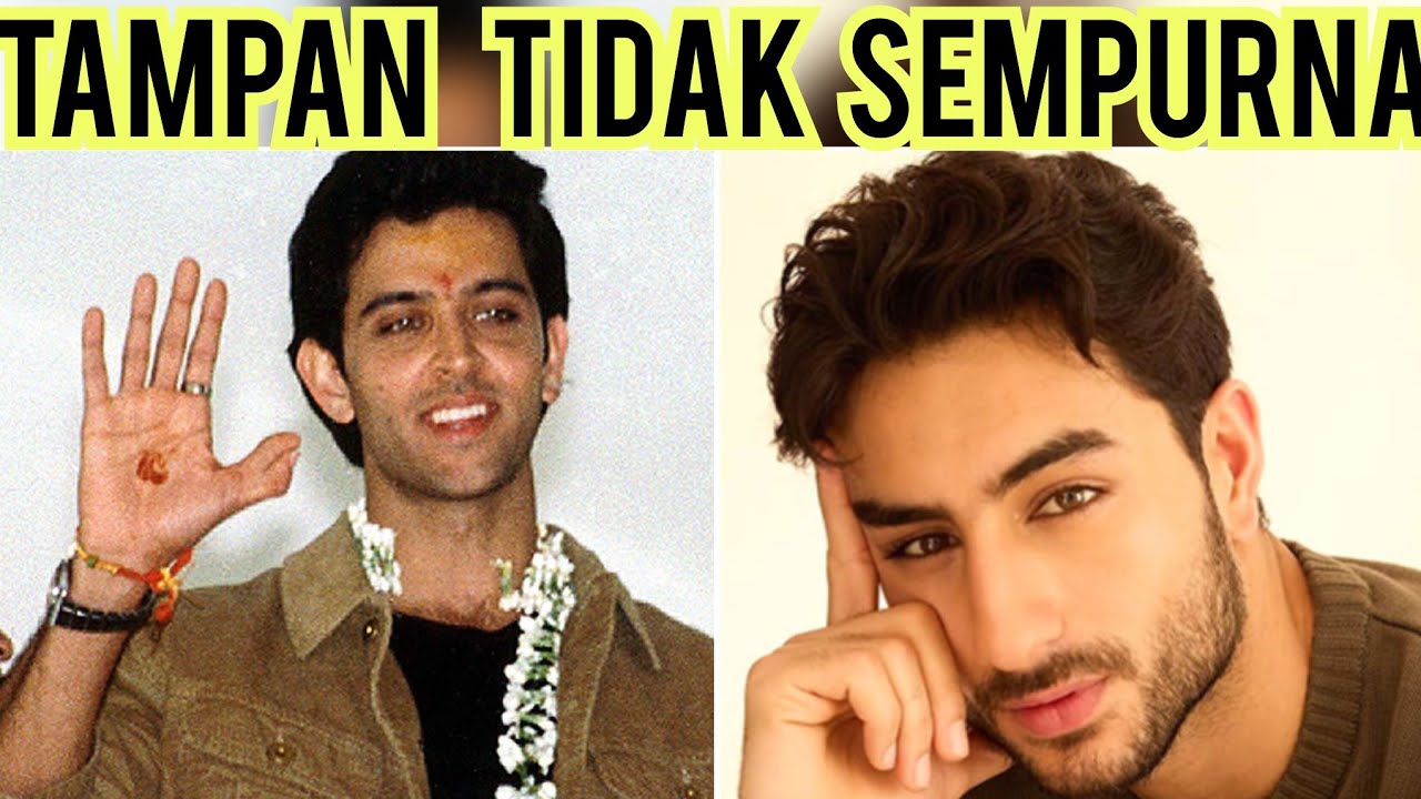 Tampan tidak sempurna | Kekurangan artis India | 