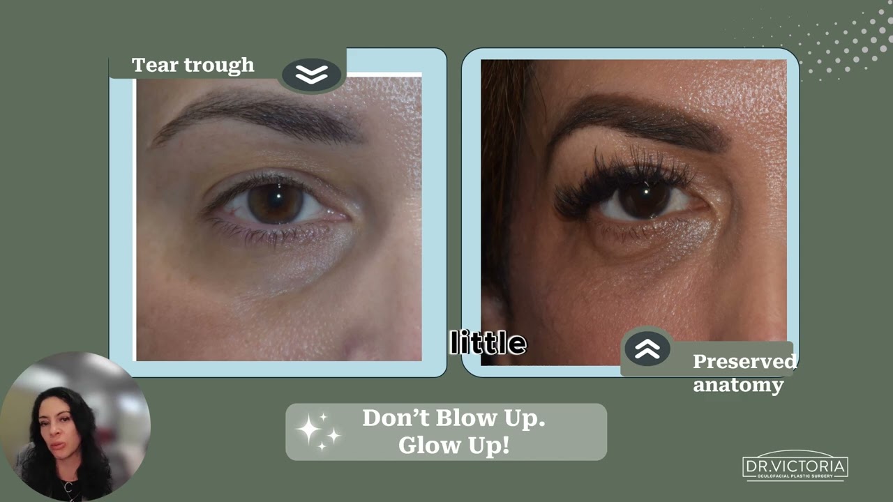 Tip to avoid Complications in Aesthetic Procedures