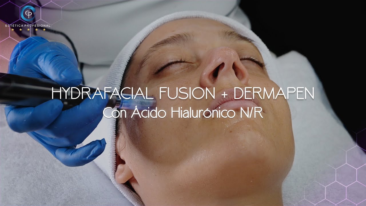 HYDRAFACIAL FUSIÓN + DERMAPEN CON ÁCIDO HIALURÓNICO N/R