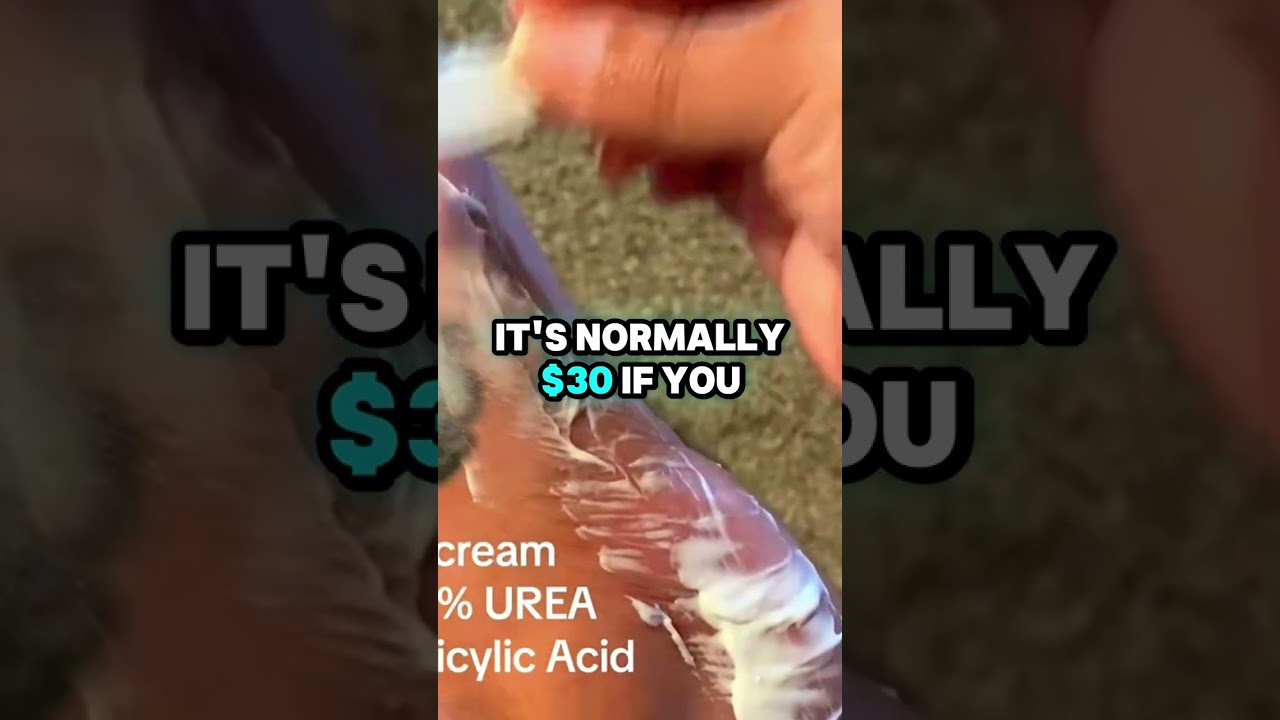 Transform dry feet with urea cream 