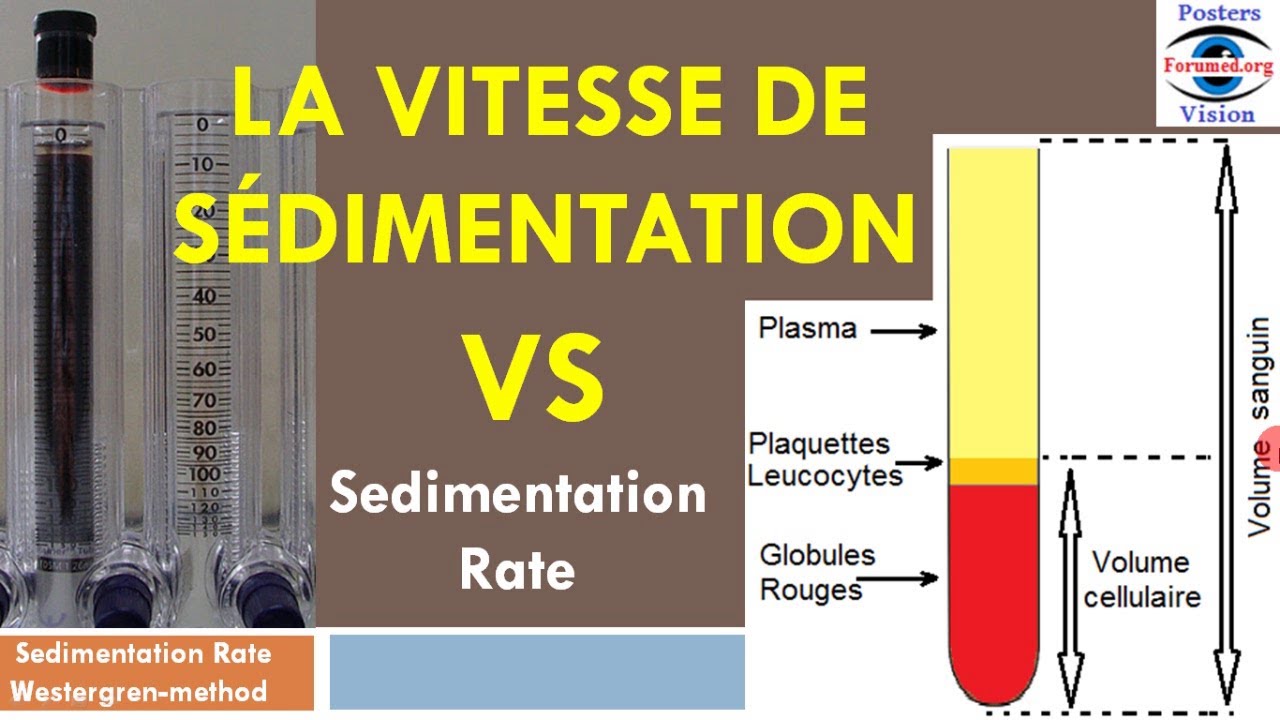 Methode Mesure de la vitesse de sedimentation rate VS ESR