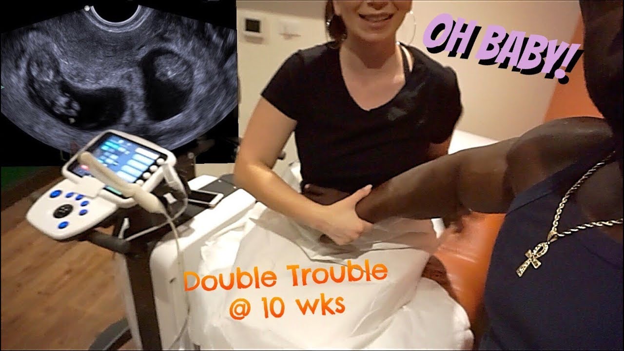 BABY'S HEARTBEATS STRONG | OUR IVF JOURNEY (Part 8)