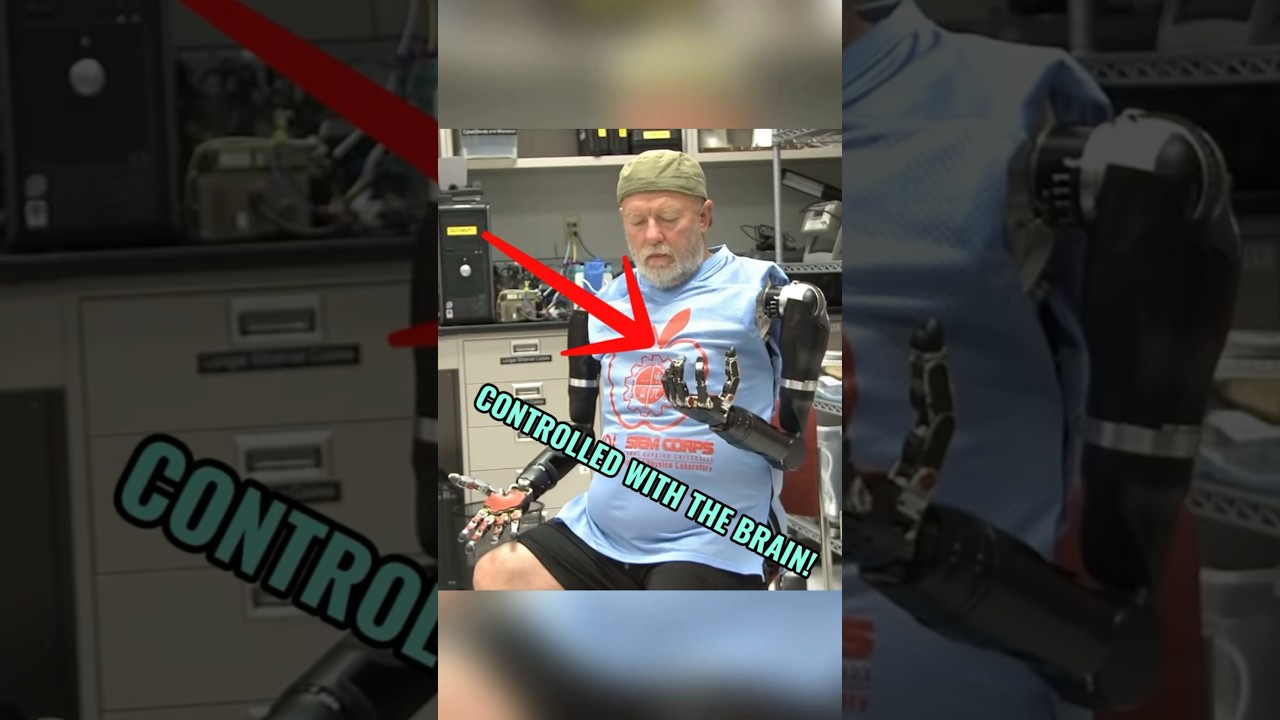 The Prosthetic That&rsquo;s Controlled With the Brain🧠