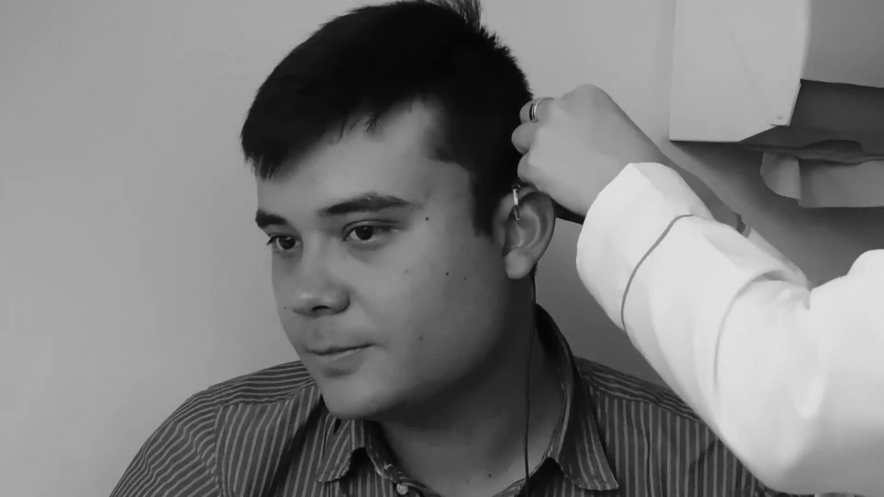 IMPLANTE COCLEAR BILATERAL TARDIO