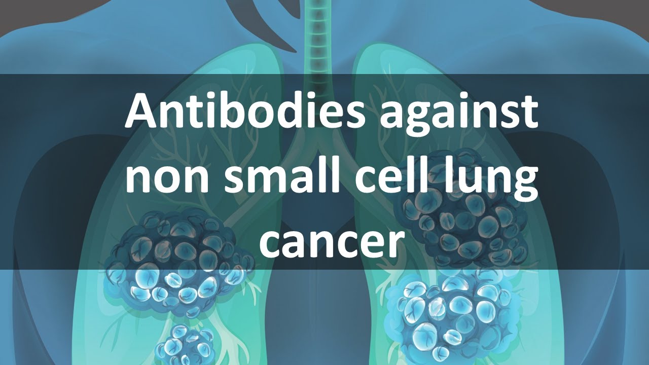 Antibodies against Non Small Cell Lung Cancer (ALK)