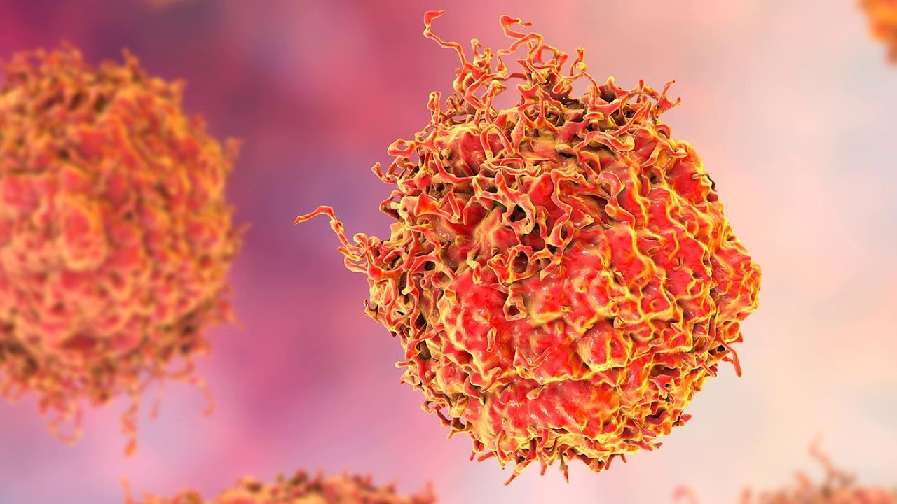 Treating Aggressive Prostate Cancer with Maha Hussain, MD