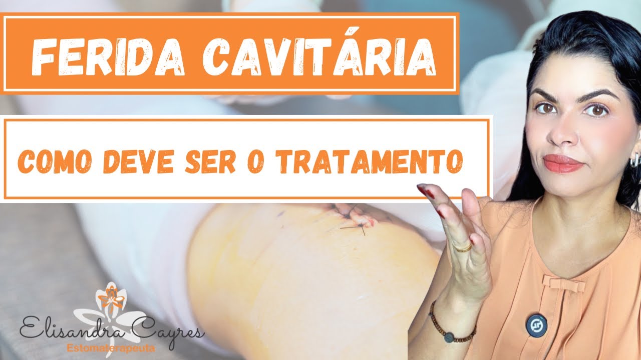TRATAMENTO DE FERIDAS CAVITÁRIAS 