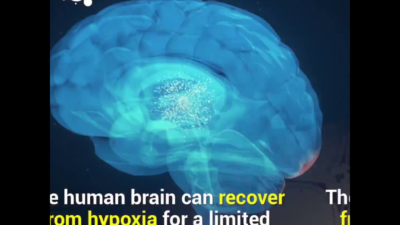 What happens to the brain without oxygen?
