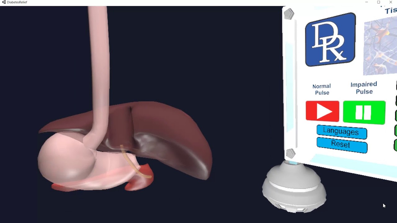 Diabetes Relief&mdash;Scientific Explanation Immersive Experience