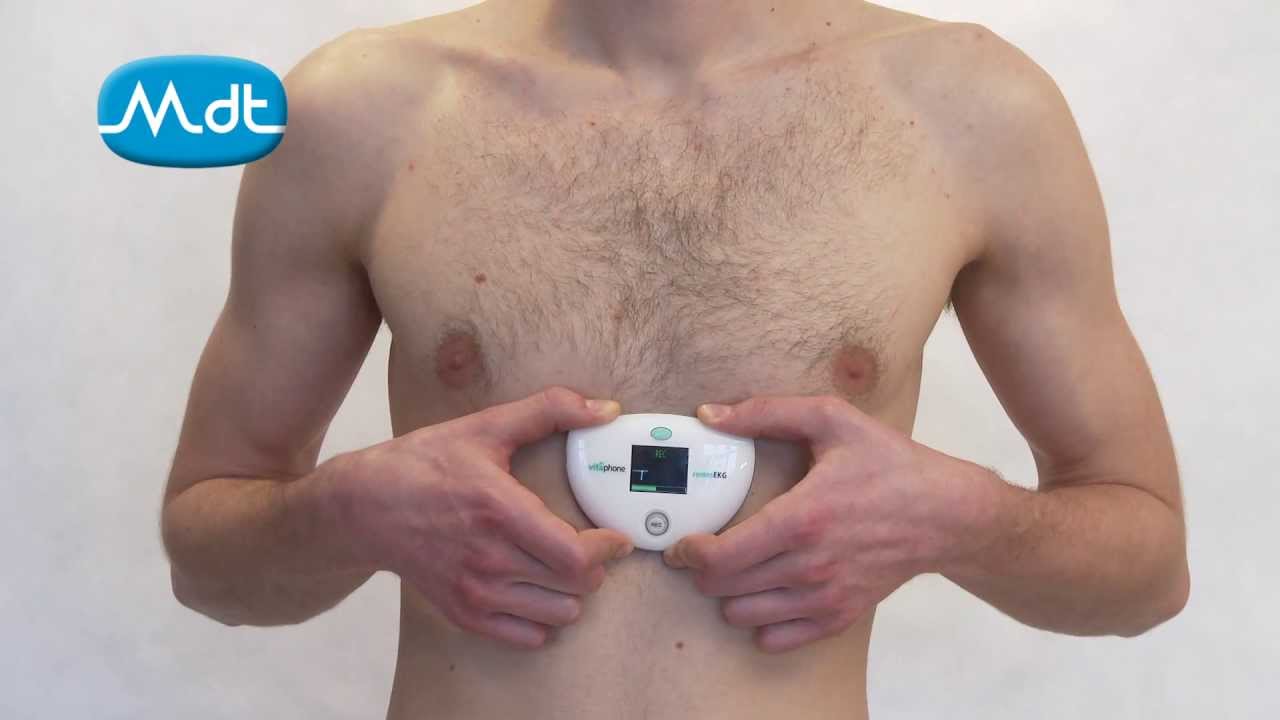 EKG kartička pro pacientem detekované události 2