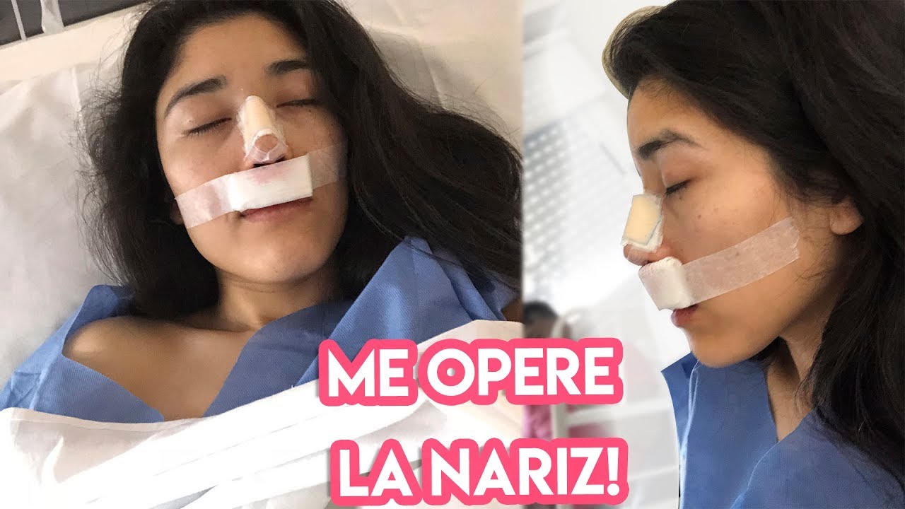 Mi rinoplastia| vlogs dia a dia |