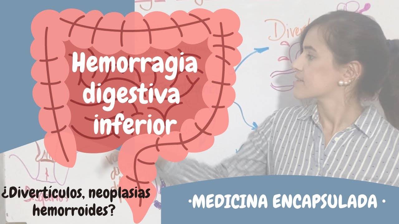 Hemorragia digestiva inferiores. causas y manifestaciones☑️ sangrado intestinal bajo🔻