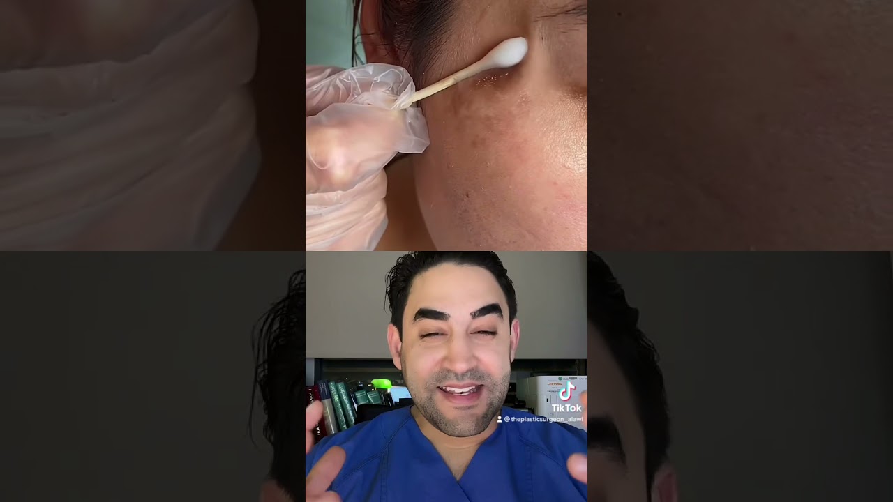 Muttermal einfach wegwischen - geht das? #haut #hautpflege