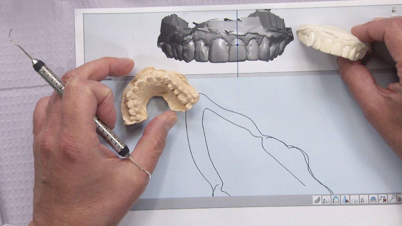 Chairside Live Episode 127: Utilizing CAD/CAM Technology to Please Patient and Practitioner