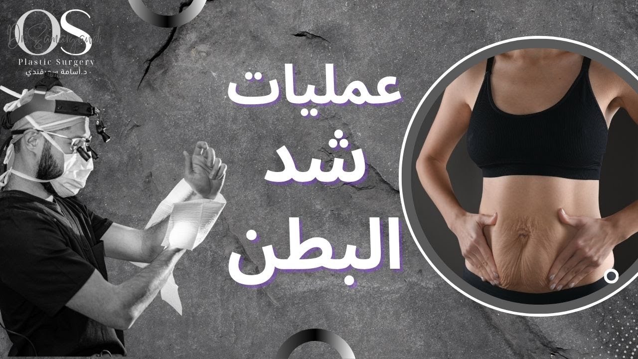 عملية شد البطن